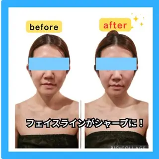 小顔FaceLabo.那覇店所属・小顔フェイスラボ 那覇店のエステ・リラクイメージ