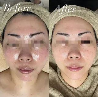 プライベートサロン Belle（ベル）のエステ・リラクイメージ