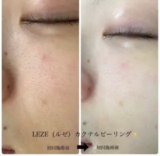 🩵Tatsumi Kana🩵のエステ・リラクイメージ