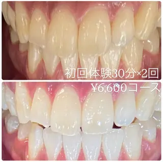 PLATINUM Beauty 横浜店所属・ホワイトニングルーム 横浜店のその他イメージ