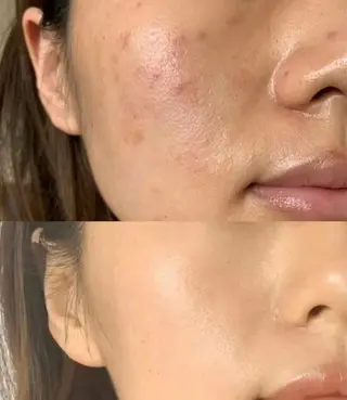 ネイル aliaハイフ&水光ジェットサロン所属・aliaハーブ水光店 エステティシャン募集のエステ・リラクイメージ