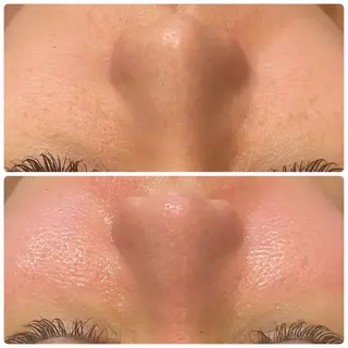 yellow.所属・yellow💛【 脱毛&フェイシャル】のエステ・リラクイメージ