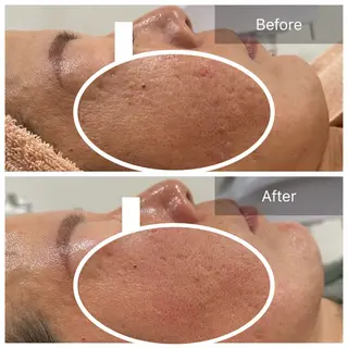 【現役看護師】高来 笑子のエステ・リラクイメージ