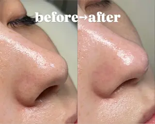 Skincare Room〜Caaka〜所属・橋本 千寿のその他イメージ