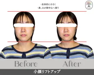 ヘッドスパ・小顔矯正　十色　横浜所属・ヘッドスパ・小顔矯正 十色　横浜のエステ・リラクイメージ