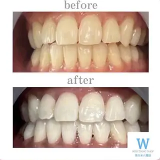 ホワイトニング ショップ本八幡店のエステ・リラクイメージ