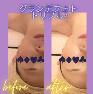 ラブニール 恵比寿店のエステ・リラクイメージ