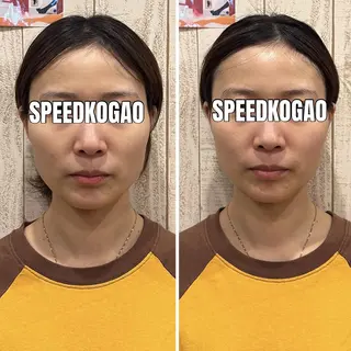 小顔矯正Speed KOGAO渋谷本店のエステ・リラクイメージ