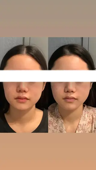 エステサロンino.colore'所属・小顔サロン ino.coloreのエステ・リラクイメージ