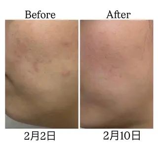 ROR Akariのエステ・リラクイメージ