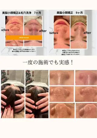 ANERA Second所属・尾上 沙織のエステ・リラクイメージ