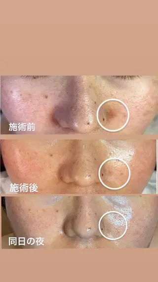 マツヤニWax専門/ 岸和田/Luanaのエステ・リラクイメージ