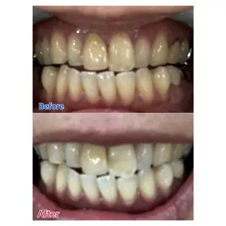 MBEAUTYSALON 千葉店・京成大久保所属・Melty 輝のその他イメージ