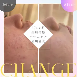 skinLabo所属・saya Mのエステ・リラクイメージ