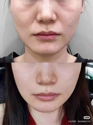 ショート aliaハイフ&水光ジェットサロン所属・aliaハーブ水光店 エステティシャン募集のエステ・リラクイメージ