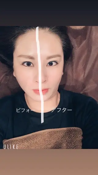 メンズ 美容鍼灸サロン LOMIHARIのエステ・リラクイメージ