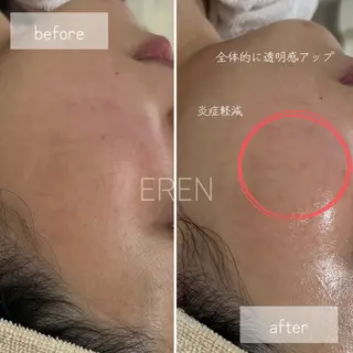 【美肌育成サロン】 エレンのエステ・リラクイメージ