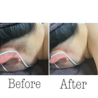 都度払い制脱毛サロンBe Charm所属・Be Charm 山﨑のエステ・リラクイメージ