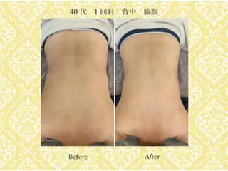 美肌専門サロン かれんのエステ・リラクイメージ