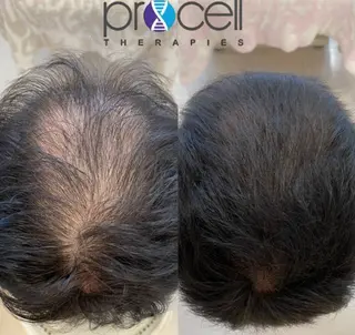 メンズ Blooming所属・LOUISE. ／肌質・頭皮のエステ・リラクイメージ