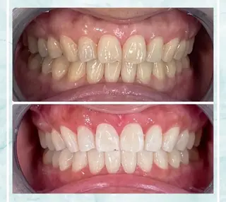 ホワイトニング ビューティ名古屋栄のその他イメージ