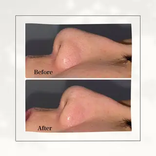 シミ・毛穴専門店 gracia 宇土店所属・シミ・毛穴専門店 /gracia 安藤のエステ・リラクイメージ