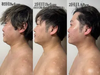 六本木脱毛andS 店長Sachiのエステ・リラクイメージ