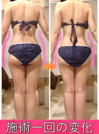 ロング カラー パーマ ヘアアレンジ メンズ キッズ ネイル マツエク・マツパ ‍痩身＆ボディ 結果出し🌟丹野のエステ・リラクイメージ