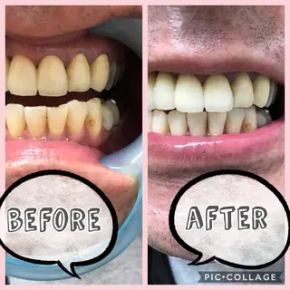 self whitening  BIOLUS所属・whitening BIOLUSのその他イメージ