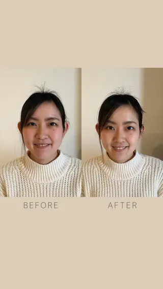 美容鍼サロン ハピネス所属・土手 真矢のその他イメージ