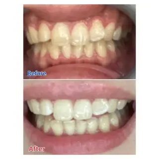 M渋谷店所属・Ｍ渋谷 ホワイトニングのエステ・リラクイメージ