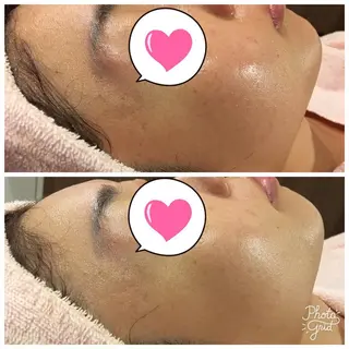 Une rencontre (ユヌ・ランコント)所属・つや肌専門店ユヌ・ ランコント中井のエステ・リラクイメージ