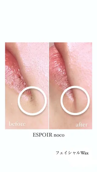 ワックス脱毛🌈 ESPOIRnocoのエステ・リラクイメージ