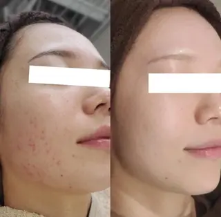 Salon b.p. 渋谷🤍Rinのエステ・リラクイメージ