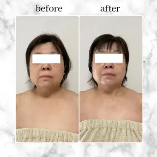 エステサロン　イデアルMe大宮店所属・イデアルMe♡ KIMISHIMAのその他イメージ