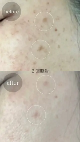 ＆epi 【エステ】のエステ・リラクイメージ