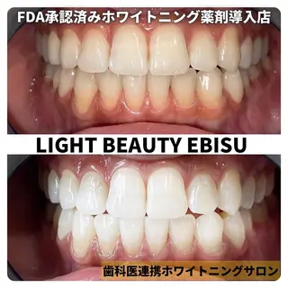 ライトビューティー 恵比寿店のその他イメージ