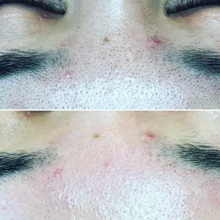 兒玉 知代の眉毛・アイブロウイメージ