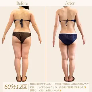 むくみ専門痩身 マクイエステティックのエステ・リラクイメージ