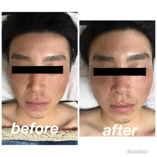 食べながら魅せボディ éclatJua川越のエステ・リラクイメージ