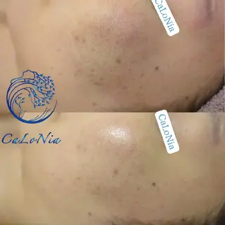 肌質改善・艶髪サロン CaLoNiaのエステ・リラクイメージ