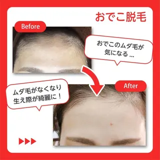 RinRin  松山店のエステ・リラクイメージ