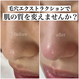 BELINDA HITOMIのマツエク・マツパデザイン