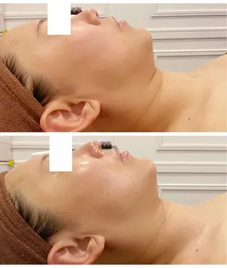 通うほど変わる本格 エステ心斎橋REVIのエステ・リラクイメージ