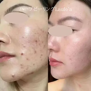 美腸サロン🌺 腸もみ/小顔/リンパのエステ・リラクイメージ