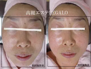 REGALO所属・矢野 さやかのエステ・リラクイメージ