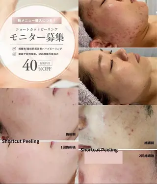 uni. abeのエステ・リラクイメージ