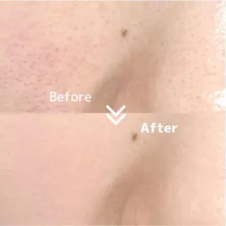 マツエク・マツパ 愛維美水光美肌専門店所属・愛維美水光美肌専門店 メンズレディースokのエステ・リラクイメージ