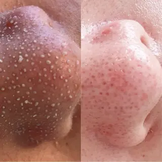 よもぎ蒸し×フェイシャルサロン  Fu 辻堂店所属・よもぎ蒸しサロン Fu  辻堂店のエステ・リラクイメージ