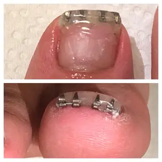 メンズ ネイル 🌱 ま し お 🌱のその他イメージ